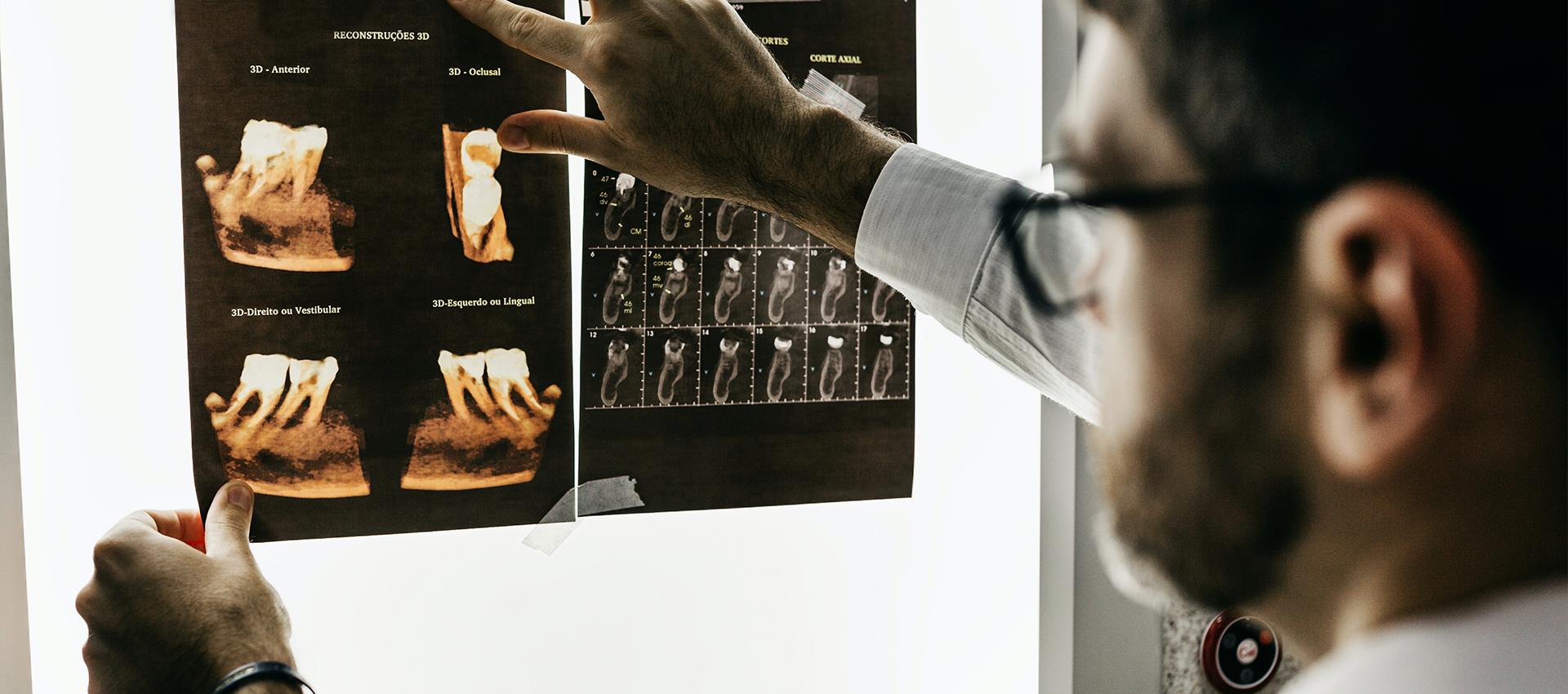 Нужна ли флюорография и как часто ее можно делать?