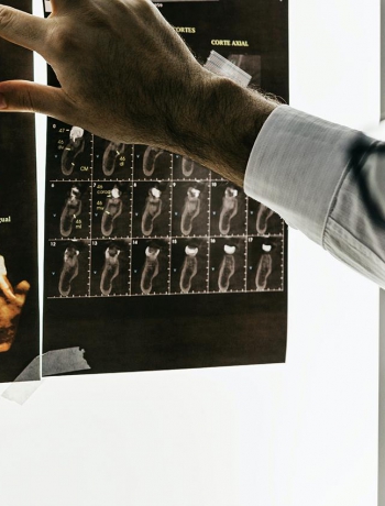 Нужна ли флюорография и как часто ее можно делать?